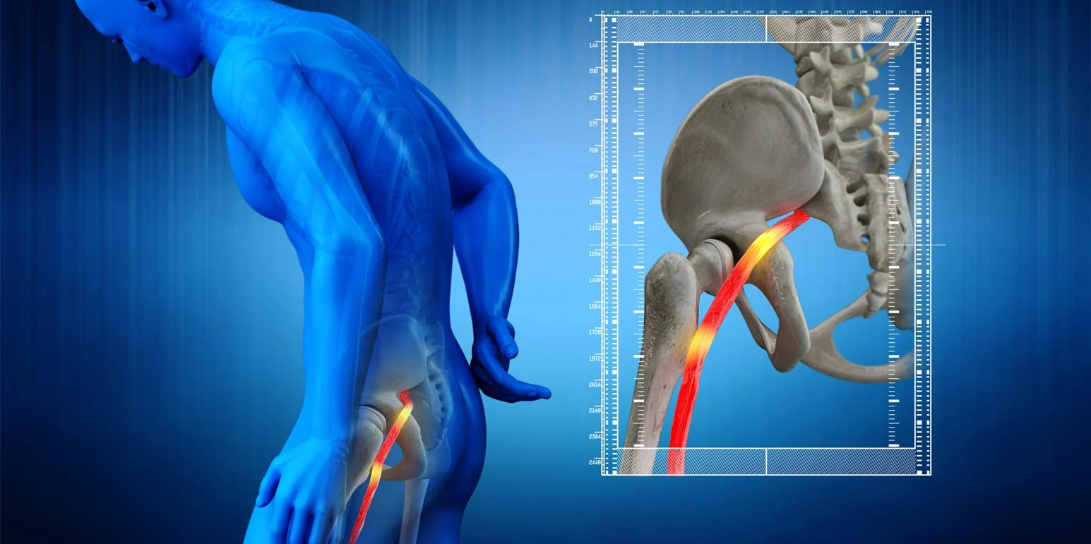 https://dfc.turnkeyitworks.com/wp-content/uploads/2022/11/Sciatica-Banner.webp